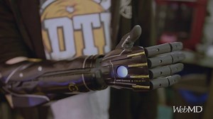 Incredible. 😯 The Hero Arm from Open Bionics is made for people 9 and older who have had an amputation below the elbow. | WebMD
