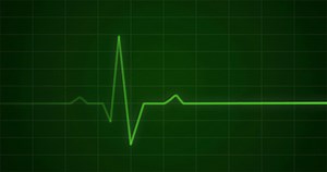 Concept Animation Of Ecg Ekg Heartbeat Stock Motion Graphics SBV-304292629 - Storyblocks