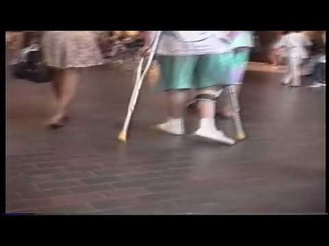 crutchman polio expo ( polio leg braces, crippled woman crutching, wheelchair)