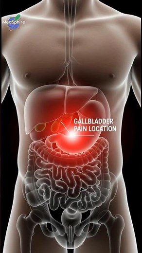 Gallbladder Pain | Right Abdominal Pain Symptoms Explained