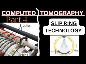 Slip Ring Technology - easily explained ☺️ #slip ring technology, #ctscan #ct #radiologyclasses