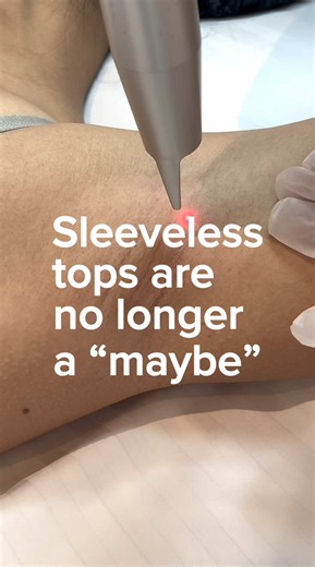 Achieve Radiant Underarms with Laser Whitening