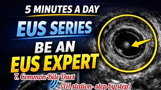 Duodenal Bulb EUS: Common Bile Duct Tracing | Step by Step | Scot Lewey, DO FACG FASGE AGAF