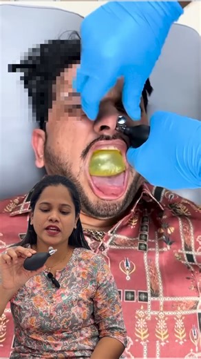 Dr. Reena shaik on Instagram: "#doctor #kurnool #nose #andhra #medical CFR Claim Medical stance Cranial bone movement ❌ Sutures fused CSF flow manipulation ❌ Implausible OSA treatment ❌ Needs PSG outcomes Migraine cure ❌ Unsupported Sinus disease treatment ❌ No ostial pathology addressed Neurodevelopmental benefit ❌ Unethical claims Safety considerations: Usually low risk, but not zero: • Epistaxis • Turbinate/mucosal trauma • Vasovagal episodes • The bigger issue → delay of proper diagnosis (OS