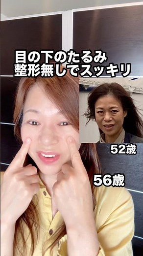 Under-eye bags | Self-care to prepare the "foundation" before surgery
