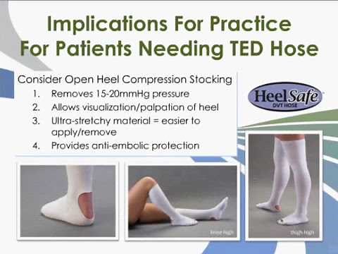Heel Pressure Ulcers Treatment