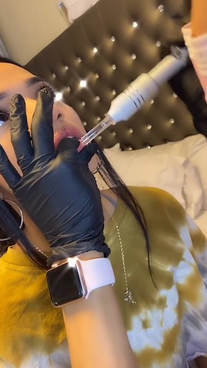 Needle-Free Lip Filler Check with @yellenaj