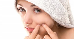 Comment soigner la rosacée ?