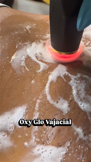 𝐓𝐡𝐞 𝐖𝐚𝐱 𝐋𝐨𝐟𝐭 𝐀𝐞𝐬𝐭𝐡𝐞𝐭𝐢𝐜𝐬 𝐆𝐮𝐥𝐟 𝐁𝐫𝐞𝐞𝐳𝐞,𝐅𝐥 | An Oxy-Glo Vajacial is a premium intimate skincare treatment for the bikini area that combines: ✨ Oxygen infusion A machine delivers... | Instagram