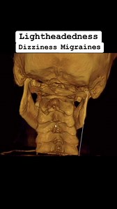 Are you lightheaded and dizzy and don’t know why? Upper Cervical care is excellent at resolving vestibular issues. Comment below for a doctor near you! #dizziness #vertigo #fyp | Montclair Upper Cervical Chiropractic