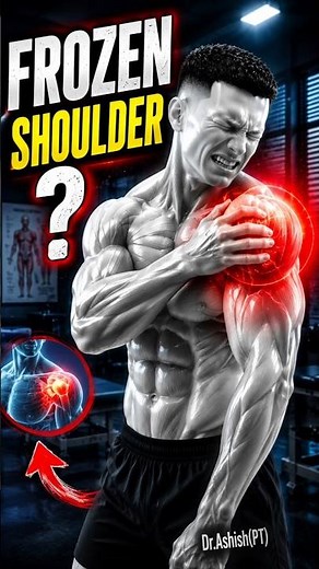 Frozen Shoulder? Try These 3 Best Physiotherapy Exercises to Reduce Pain Fast!