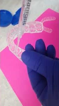 How to load a whitening tray - Wheaton cosmetic dentist