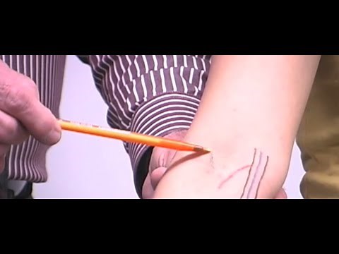 Part 1. Basics of a Blood Draw with Bill White RN