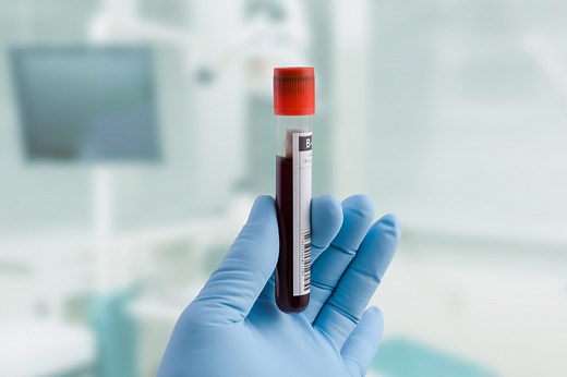 Golden blood: the rare and mysterious Rh-null blood type