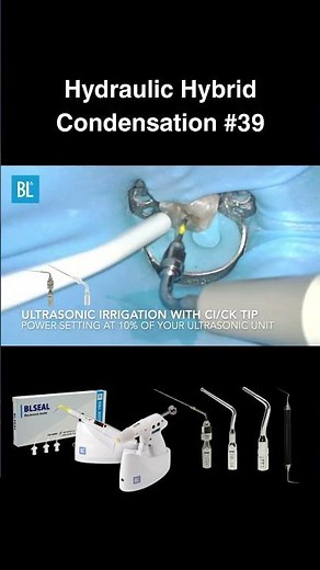 Hydraulic Hybrid Condensation #39