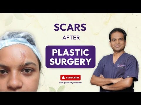Plastic Surgery Scars Explained