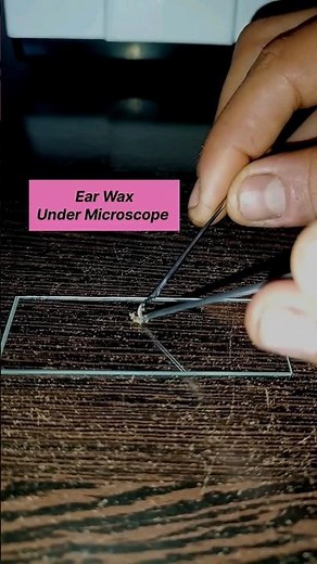 Ear Wax Under Microscope 👂👂 #microscopeview #microscope #shorts #trending #observation #earwax