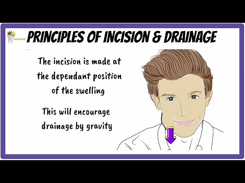 Basic Principles of INCISION and DRAINAGE