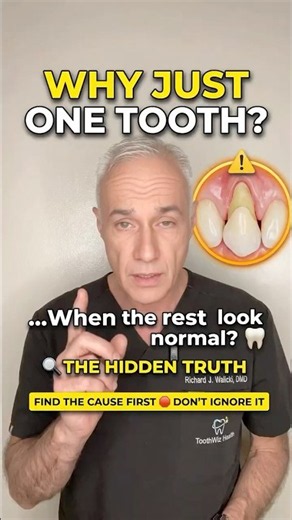 Why Is My Gum Receding Around Just ONE Tooth? 🦷