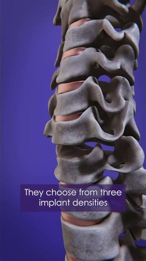 DEXA Technology™ introduces innovative treatment options for patients. #medicalanimation