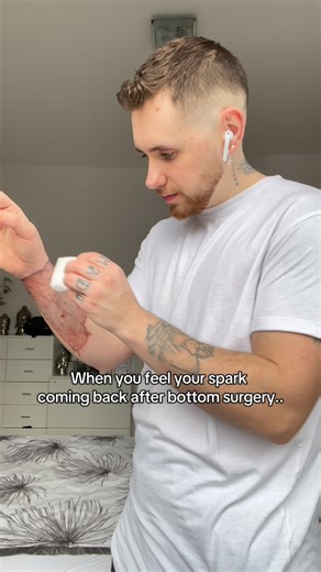 Jay Moch on Instagram: "I gained weight. I lost strength. I lost myself. Bottom surgery, recovery, mental breakdowns, surgeries on top of surgeries… I was broken. But I rebuilt myself. Mentally. Physically. Emotionally. This is me now.. stronger, wiser, and still healing, but better than ever. If I could do it… why can’t you? 👉 Need a plan that’s made for your body & journey? My app has personal training + meal plans. Link in bio 🖤"