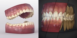Free 3D Teeth with Textures