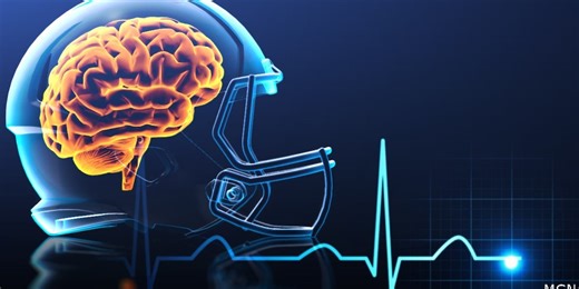 Kids’ concussions: Whose responsibility is it anyway?