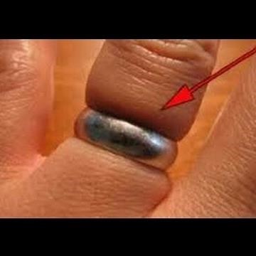 Cómo sacar un anillo atorado en el dedo (Sin dolor) || Te puede servir