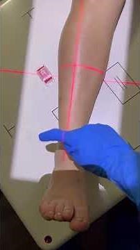 Tib/Fib X-Ray Positioning
