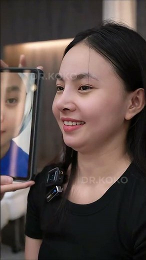 Setelah 1 bulan melakukan operasi hidung di KOKO #kokoclinic #drkoko