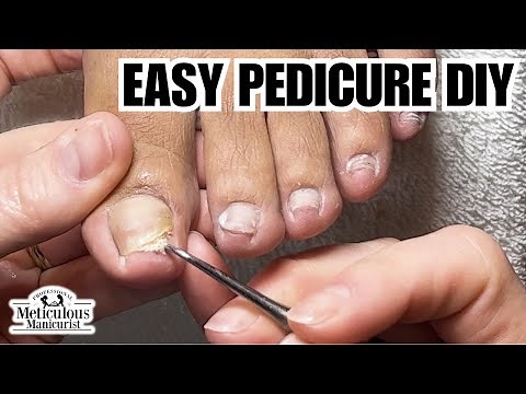 Easy DIY Pedicure Tutorial on Impacted Toenails