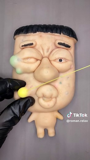Relax Pimple Popping #foryoupage #fyp #fypviralシ #tiktokusa #oddlysatisfying
