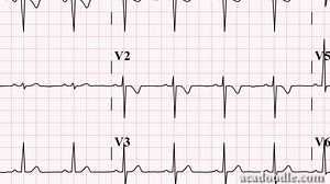 75K views · 568 reactions | Improve your ECG skills -...