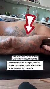 19K views · 141 reactions | ⚡️朗 A trigger point in a muscle can cause strain and pain throughout the muscle. . . . . . . . . . #triggerpoint #triggerpoints #triggerpointrelease #bodypain #musclepain #tension #massage #fbreels #physio #physicaltherapist #physicaltherapysession #foryou #triceppain #tricepspain #triceps #muscletwitch | Physical Therapy Session | Facebook