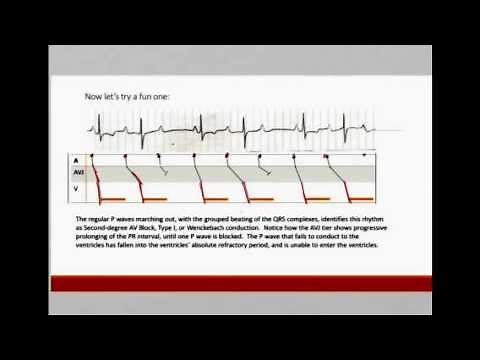 How to Make a Laddergram