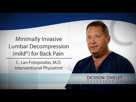 Minimally Invasive Lumbar Decompression (mild®) for Back Pain