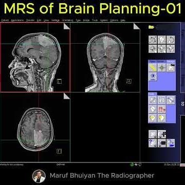 MRS of Brain Technique -01 | #mri #radiographer #ctscan #medicalimaging #radtech #spectroscopy