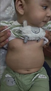 pneumonia assessment & Lower chest indrawing in children #pediatrics #medical #health #science