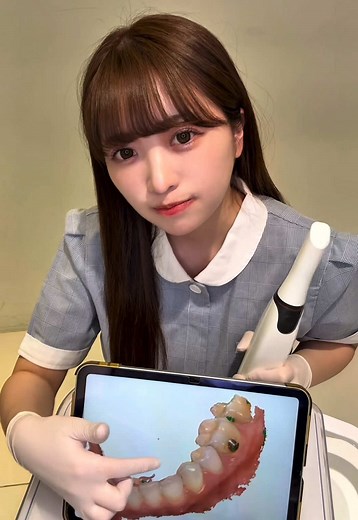 3Dスキャンで歯型を精密に取得する方法
