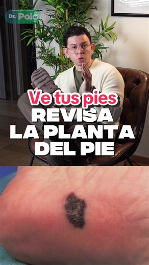 ¿Cómo identificar un lunar peligroso?