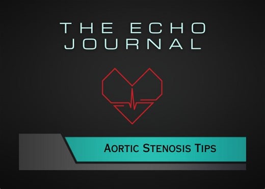 The Assessment of Aortic Stenosis