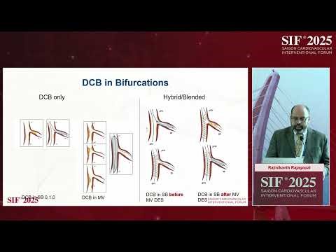 Room A- A5- DCB angioplasty: what next?