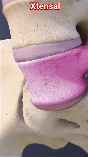 L5-S1 Spinal Problems Explained | Herniated Disc, Sciatica & More