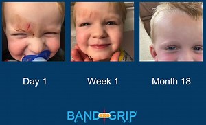 Watch BandGrip to the rescue after an accidental minor injury on Amazon Live