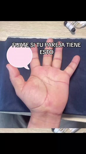 Lectura de Manos: Interpretación del Monte de Venus