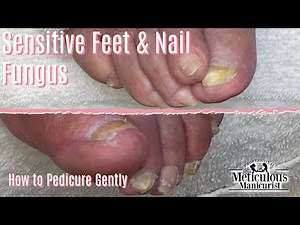 How to Pedicure on Elderly Toenails Gentle Cleaning
