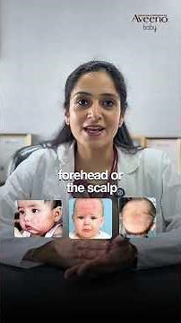 Baby Skin Care Tips for Atopic Dermatitis | Expert Advice by Dr. Nimisha