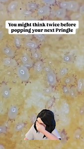 3 Main Types if Parasites 🦠protozoa, helminths & ectoparasites Protozoa:-Amoeba. Move by pseudopodia. Trematodes-Leaf-like unsegmented Cestodes-Tape-like segmented Tapeworms/Roundworms - have a series of hooks they use to attach to the intestine to get nourishment from the host, & can grow up to 30 feet Flukes- invade the nervous system secondarily after blood, liver, intestinal, or pulmonary infection & can stay in the human body for 10-20 years The Tapeworm develops into adulthood in about a 