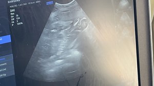 78K views · 1.2K reactions | “Sohni”-gram alert Here’s a first look at a second pregnancy for a special, endangered species at Disney’s Animal Kingdom! Hint, hint: Think stripes on Maharajah Jungle Trek! Stay tuned for more. | Disney's Animals, Science and Environment | Facebook