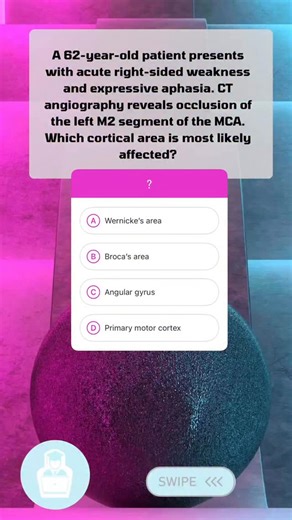 YouGottaPractice on Instagram: "Explanation: • ✅ B. Broca’s area – Correct. Located in the inferior frontal gyrus, supplied by superior division of MCA, explains expressive aphasia. • ❌ A. Wernicke’s area – Incorrect. Supplied by inferior MCA division, would cause receptive aphasia. • ❌ C. Angular gyrus – Incorrect. Lesions cause Gerstmann syndrome (acalculia, agraphia, finger agnosia, left-right confusion). • ❌ D. Primary motor cortex – Incorrect. Could cause hemiparesis but not isolated expres